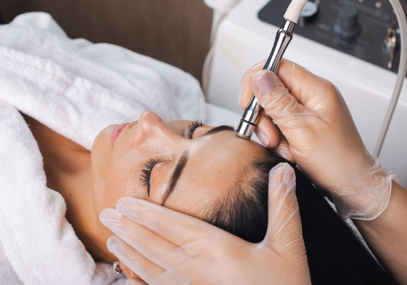 Microdermabrasion Treatment Manukau